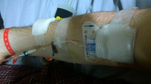 PICC line inserted at right elbow.