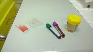 Slides, samples and biopsy.