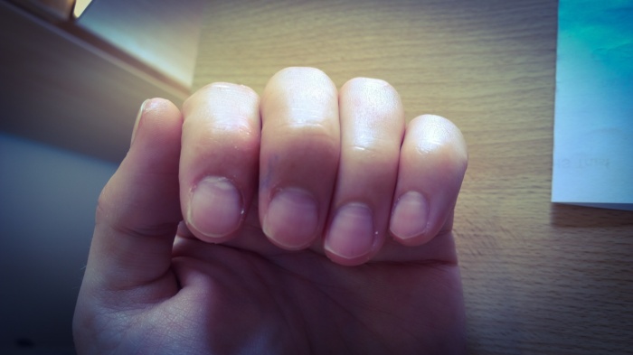 Stripy finger nails
